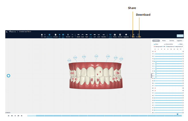 Vincismile Software System Clinical Application